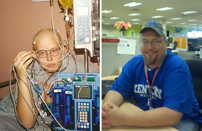 NTD Before After Pics Of People Who Beat Cancer9 - 