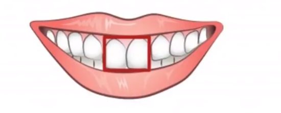 前歯の形で分かる性格テスト