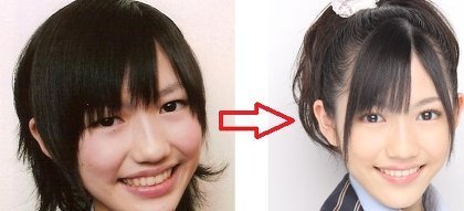美容整形で顔が変わった芸能人ランキング Before After写真を大公開 Hachibachi 美容整形で顔が変わった芸能人ランキング Before After写真を大公開 Hachibachi