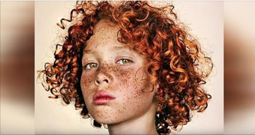 stunning freckles.png?resize=412,232 - Photographer Only Takes Pictures Of People With Freckles To Show A Different Kind Of Beauty
