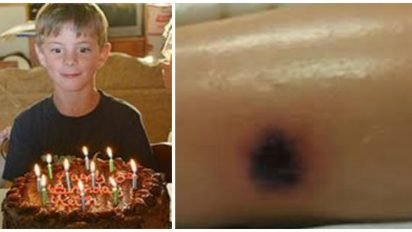 keith repost cover 412x232.jpg?resize=412,232 - 10-Year-Old Boy Dies 2 Weeks After Bruise Looking Spot Appears On His Leg