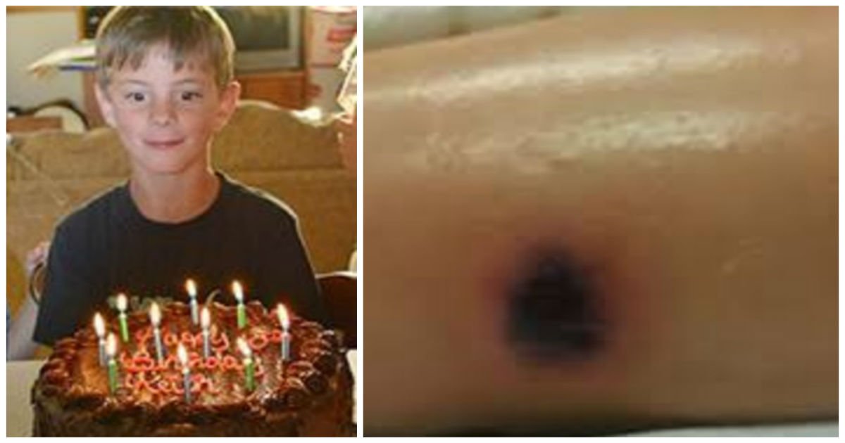 keith repost cover.jpg?resize=1200,630 - 10-Year-Old Boy Passed Away Two Weeks After Strange Mark Appeared On His Leg