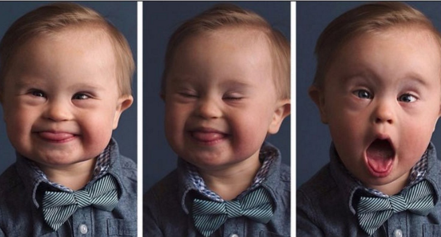 babyasher.png?resize=412,232 - Boy With Down Syndrome Became A Model After Getting Rejected By Clothes Magazine