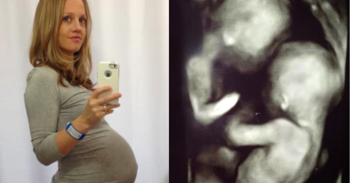 pregnant with rare twins.jpg?resize=1200,630 - Pregnant Woman Discovered One Of Her Twins' Umbilical Cord Was Harming The Other