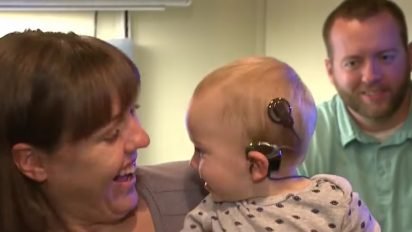 cochlear 412x232.jpg?resize=412,232 - Baby Heard His Parents' Voices For The First Time And His Reaction Is Melting People's Hearts