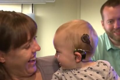 cochlear 412x275.jpg?resize=412,275 - Baby Heard His Parents' Voices For The First Time And His Reaction Is Melting People's Hearts