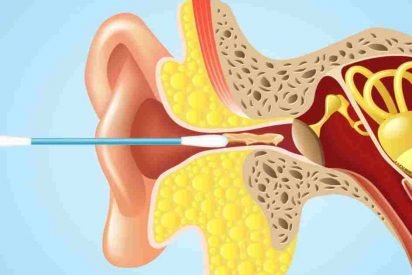 no more qtips 412x275.jpg?resize=412,275 - Wow! Scientist Explains Why Q-Tips Are So DANGEROUS For Your Ears!