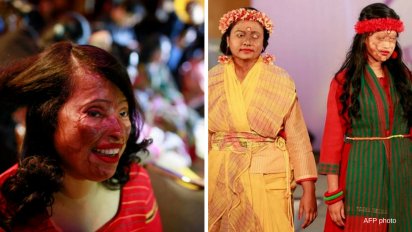 reuters clodagh kilcoyne 1 412x232.png?resize=412,232 - Bangladesh: des femmes victimes d’acide défilent sur un podium