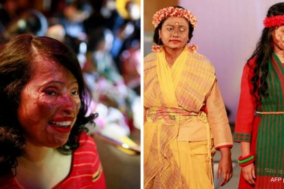 reuters clodagh kilcoyne 1 412x275.png?resize=412,275 - Bangladesh: des femmes victimes d’acide défilent sur un podium