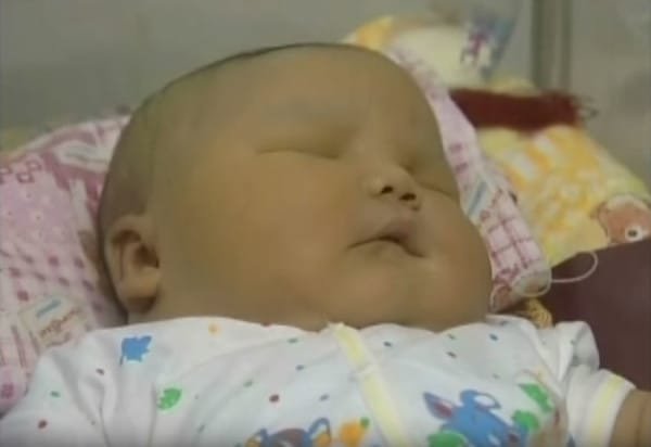 Mother Gave Birth To A Large, Record-Breaking Baby That Weighed Nearly