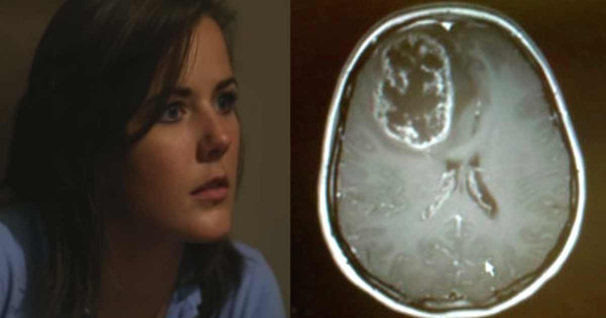 brain tumor polio.jpg?resize=1200,630 - She's Been Having Bad Headaches, But When The Doctors Take An MRI, They Notice It