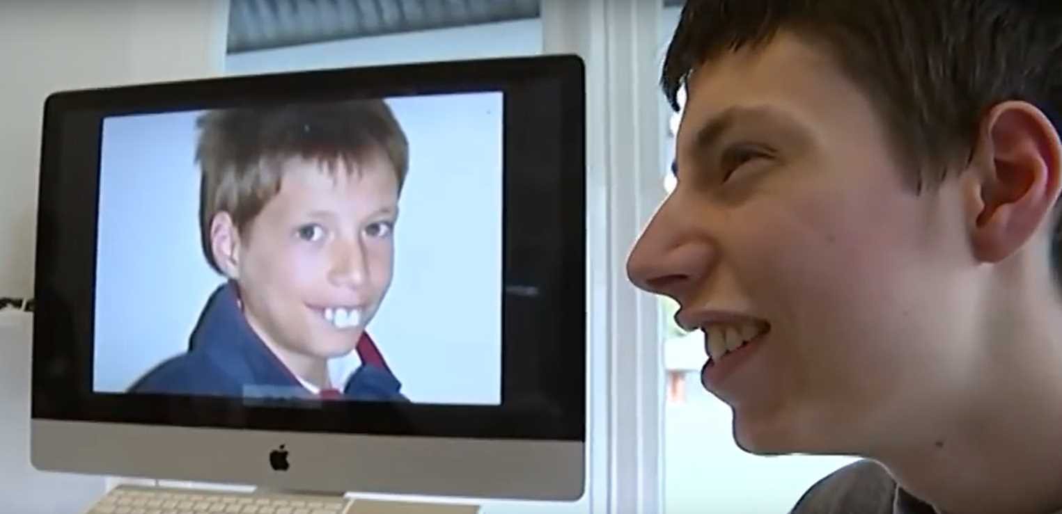 Boy Faced Constant Bullying For Years Due To His Teeth But Wait Until You See Him Now! bucktoothed kid transformation 2 1024x496 - Boy Faced Constant Bullying For Years Due To His Teeth But Wait Until You See Him Now!
