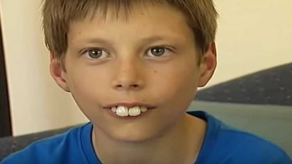 bucktoothed kid transformation 412x232.jpg?resize=412,232 - Boy Who Faced Constant Bullying Because Of His Teeth Now Finally Smiles With Confidence