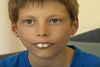 bucktoothed kid transformation 412x275.jpg?resize=412,275 - Boy Faced Constant Bullying For Years Due To His Teeth But Wait Until You See Him Now!