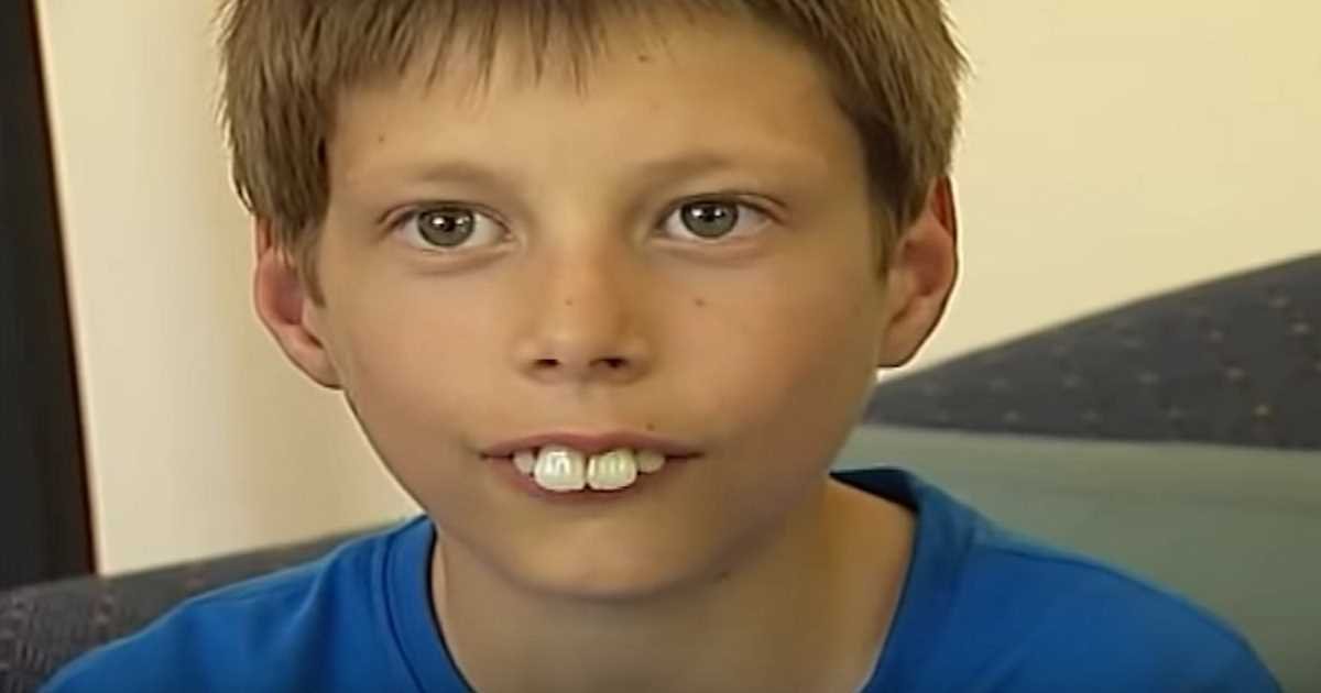 bucktoothed kid transformation.jpg?resize=1200,630 - Boy Who Faced Constant Bullying Because Of His Teeth Now Finally Smiles With Confidence