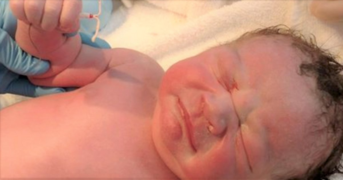 Un Bebe Pose Avec Le Sterilet Qui Aurait Du Empecher Sa Naissance Vonjour