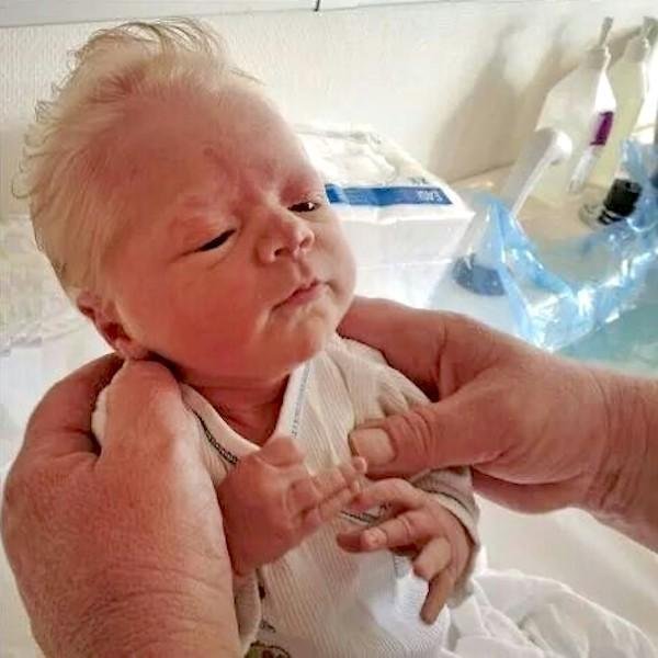 Les Parents Ne Comprennent Pas Pourquoi Leur Bebe Est Ne Avec Des Cheveux Argentes Et Les Medecins Decouvrent Rapidement Pourquoi Vonjour Les Parents Ne Comprennent Pas Pourquoi Leur Bebe Est Ne Avec Des Cheveux Argentes Et Les Medecins Decouvrent Rapidement Pourquoi Vonjour
