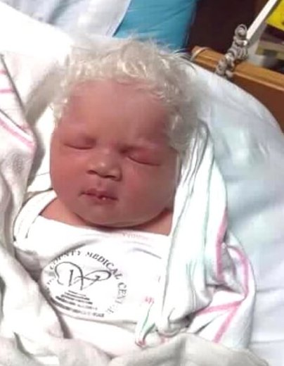 Baby Born With Silver Hair Due To Rare Condition That Causes Pigment ...