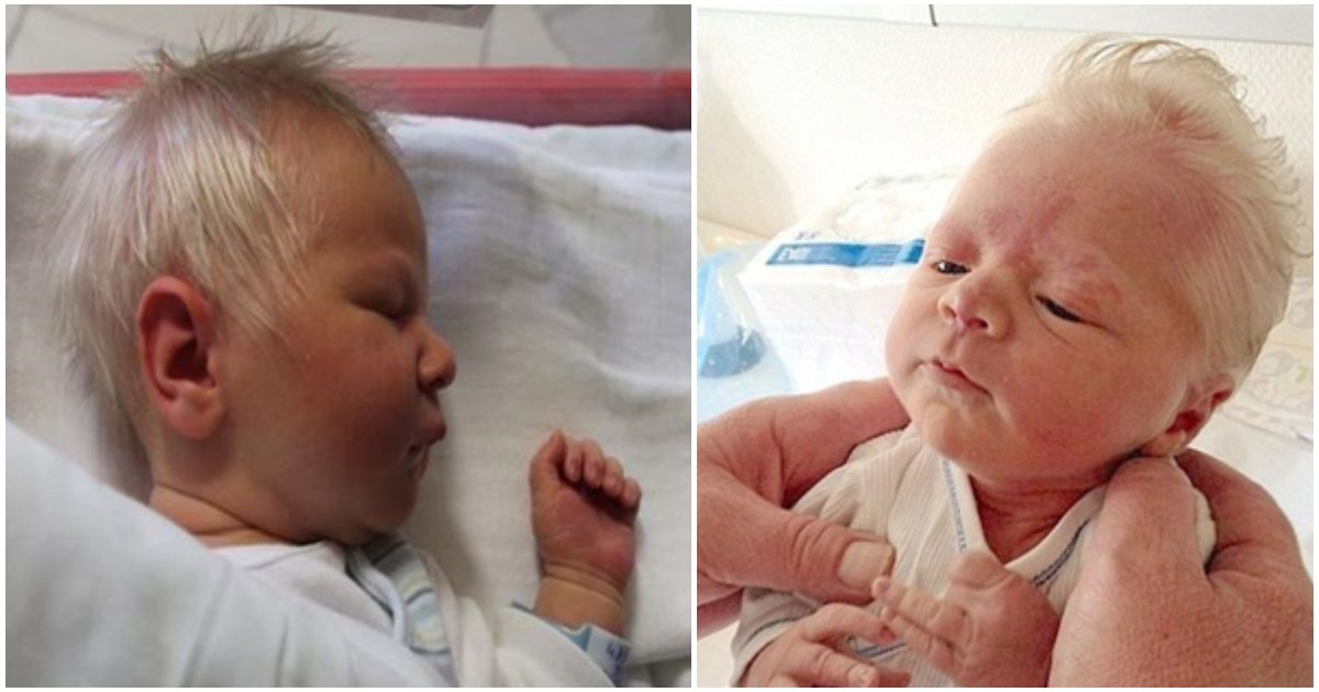 Baby Born With Silver Hair Due To Rare Condition That Causes Pigment Shortage In Hair Small Joys