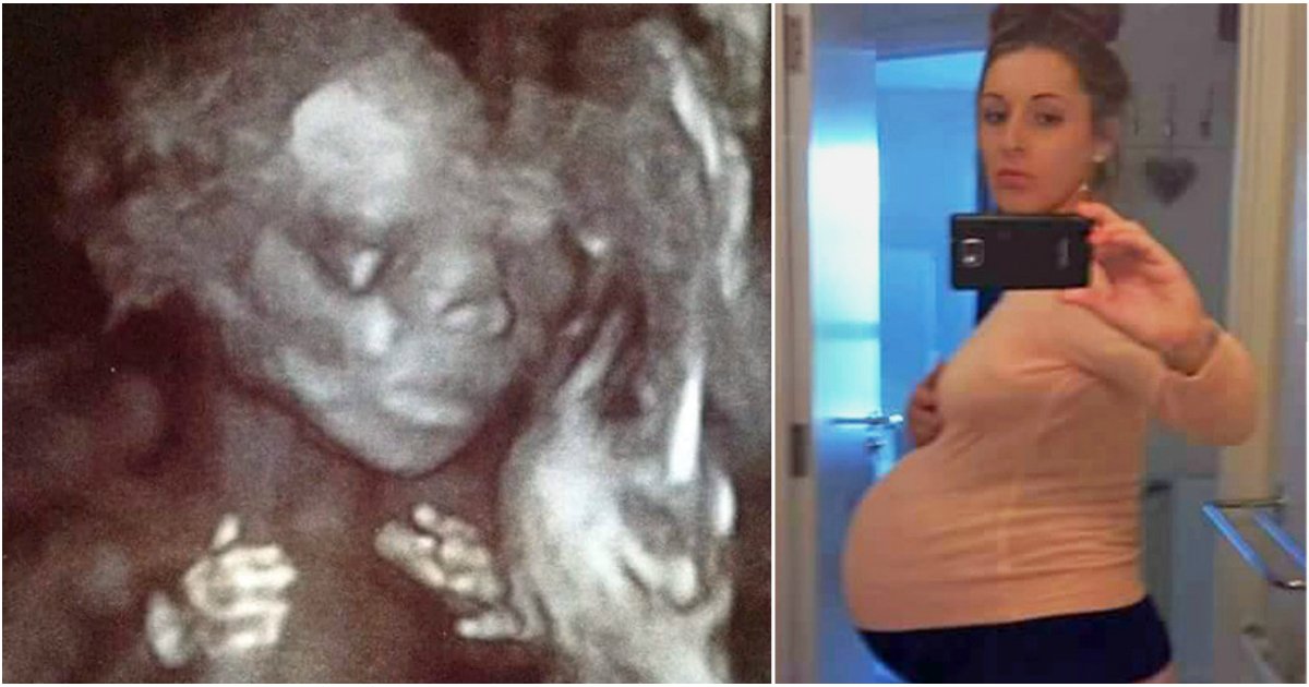 surrogate mother triplets 1.jpg?resize=412,232 - 21-Year-Old Surrogate Has Baby For Couple. Then, Midwives Notice Something Unusual In Ultrasound