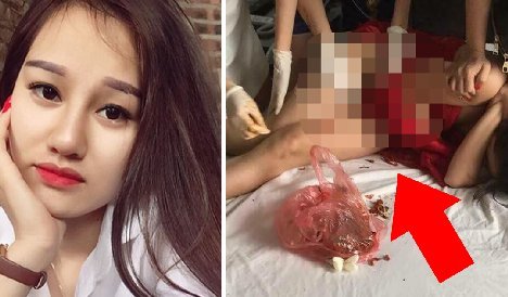 当然な処罰だvsなぜ女性だけ?・・・夫の不倫相手の性器唐辛子をかけた女性 0 10 - 当然な処罰だvsなぜ女性だけ?・・・夫の不倫相手の性器唐辛子をかけた女性