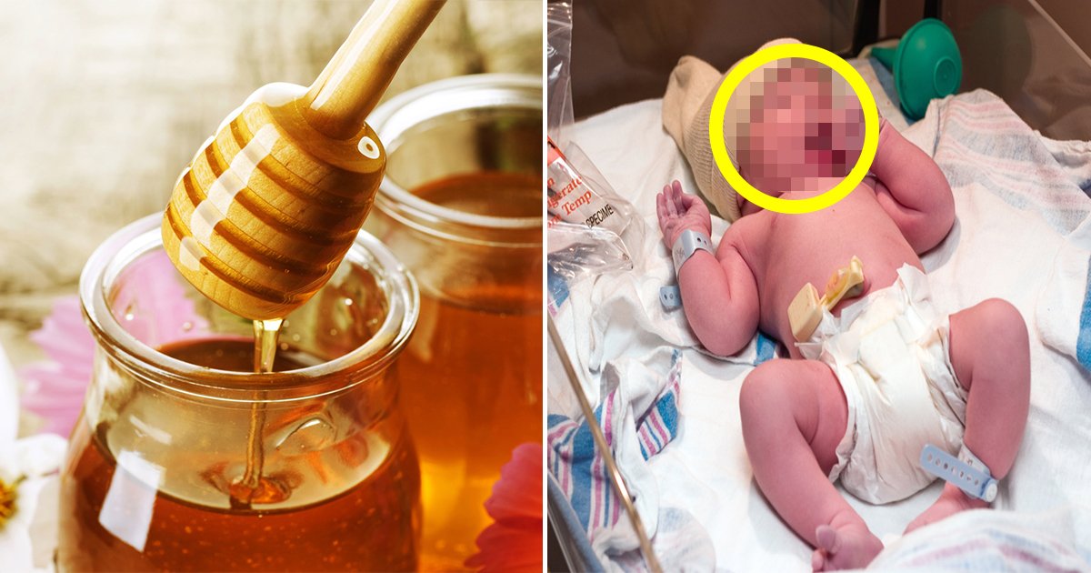 article thumbnail 1.jpg?resize=1200,630 - ‘꿀’먹고 한 달만에 사망한 생후 4개월 아기...'이유는?'