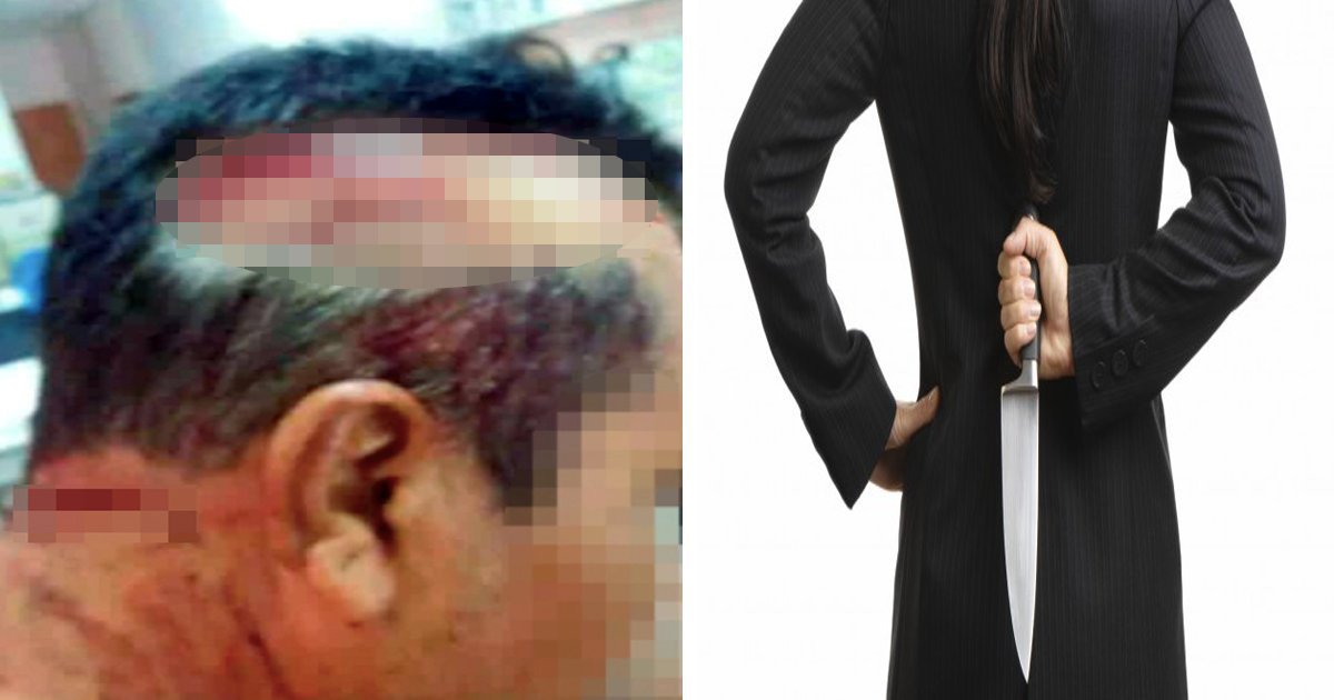 article thumbnail22 1.jpg?fit=1024%2C538&ssl=1&strip=all - “첩 들이고 싶다” 했다가… 격분한 아내에게 ‘칼’ 맞은 남성