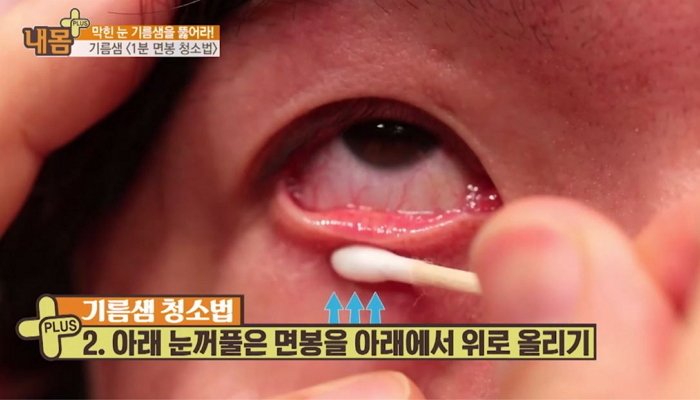 TV조선 '내 몸 플러스'