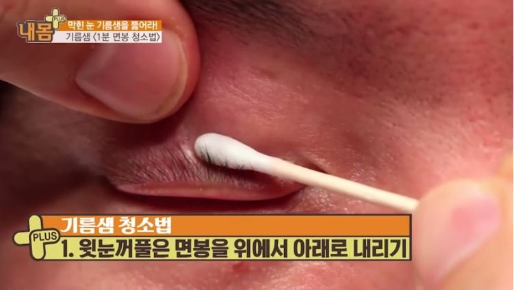TV조선 '내 몸 플러스'