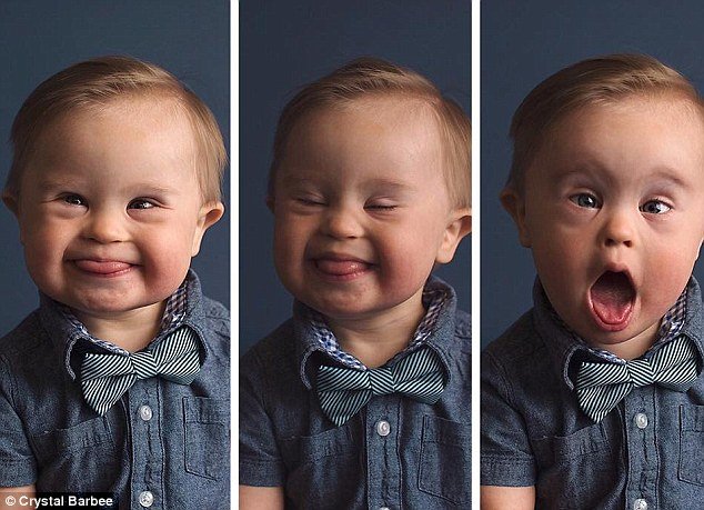 39ba738d00000578 3873862 image a 3 1477471914396.jpg?resize=412,275 - Baby Rejected For A Clothing Commercial 'Because He Has Down's Syndrome'