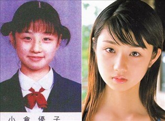 ママタレ小倉優子に整形の疑惑 Hachibachi ママタレ小倉優子に整形の疑惑 Hachibachi
