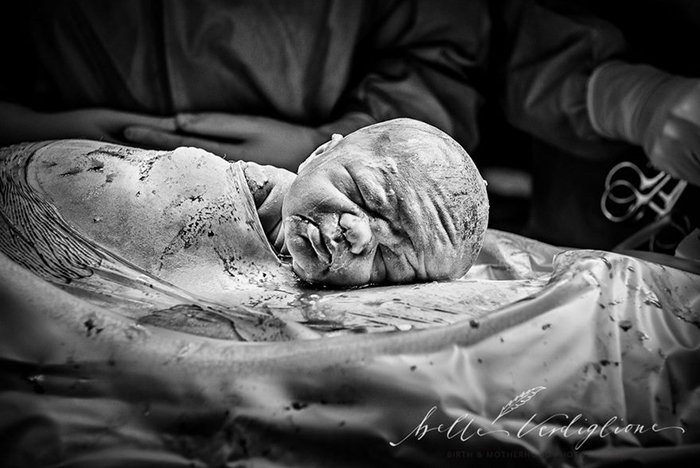 birth-photography-2017-contest-winners-iapbp-19