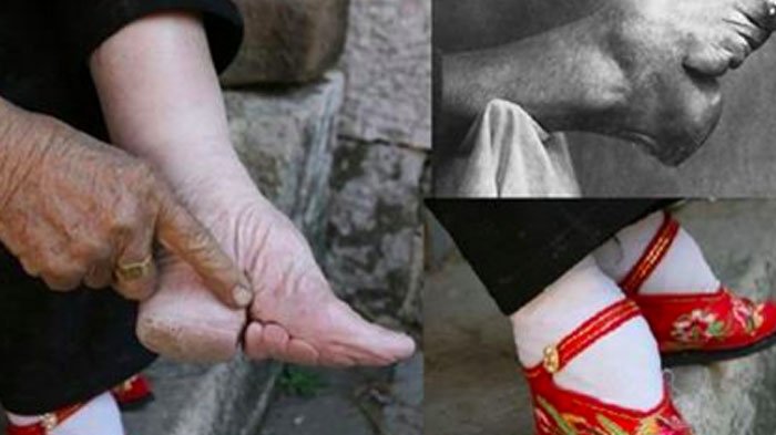 chinas foot binding0 1.jpg?resize=412,275 - The Last Woman To Follow China's 1000-Year-Old Foot-Binding Tradition Shows The Damage Done