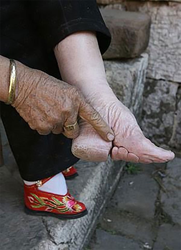 The Last Woman To Follow China's 1000YearOld FootBinding Tradition