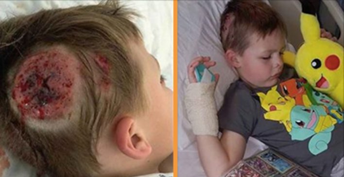 ecbaa1ecb298 48.png?resize=412,232 - A Boy Got Serious Injury On His Head By School Bully