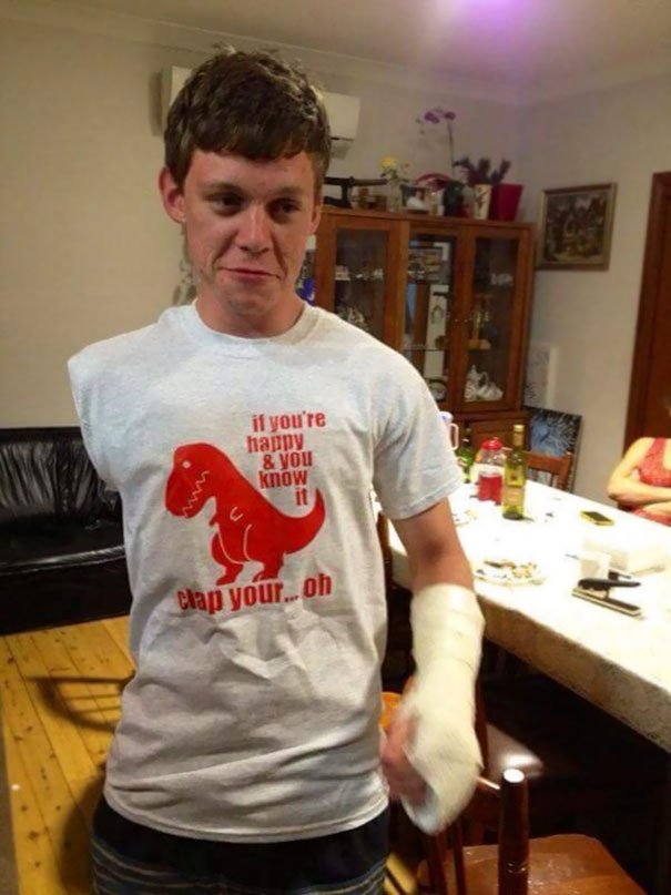 funny amputee shirts