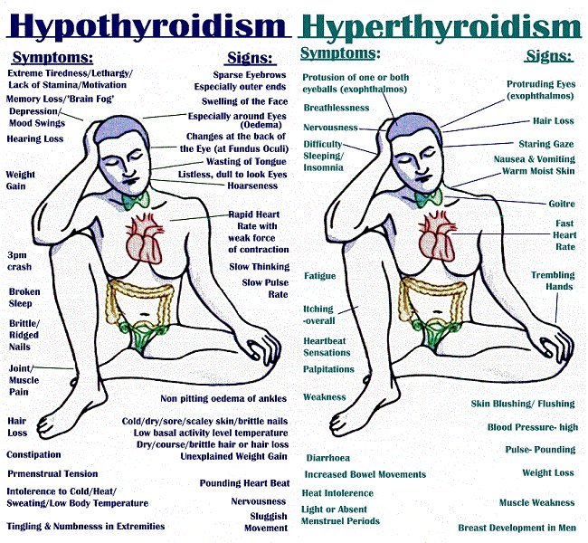 _hyperthyroidism-symptoms