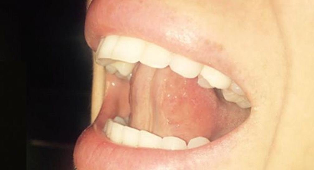 if you touch the roof of your mouth with your tongue and breathe this happens to your body.jpg?resize=412,232 - If You Have Trouble Falling Asleep, Just Touch The Roof Of Your Mouth!