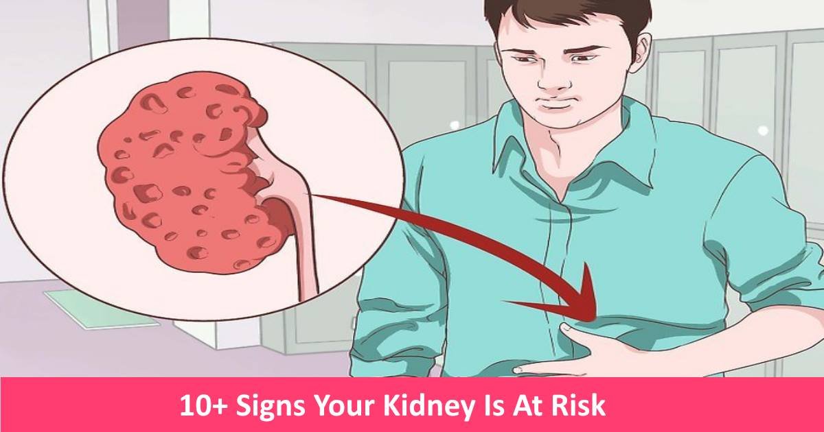 kidneyhealth.jpg?resize=1200,630 - Excessive Fatigue? Here Are The 12 Early Warning Signs Of Kidney Disease