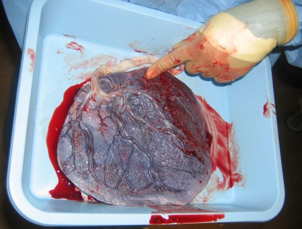 placenta-jpg