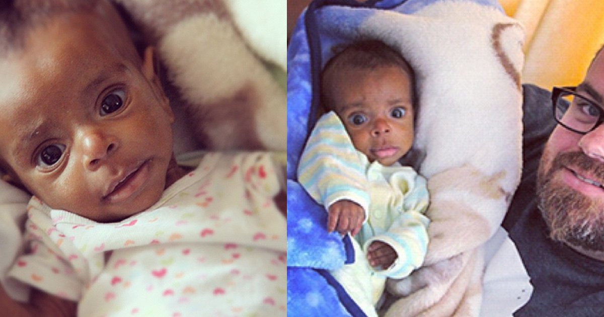 thumbnail4.png?resize=412,275 - Família adota um órfão desnutrido. Em três anos, ele está completamente diferente!