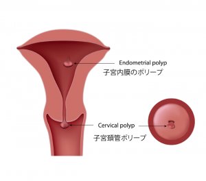 妊娠初期で鮮血の出血があった場合はどんな時 Hachibachi 妊娠初期で鮮血の出血があった場合はどんな時 Hachibachi