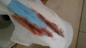 着床したらどうなる 着床後の自覚症状の表れ方 Hachibachi 着床したらどうなる 着床後の自覚症状の表れ方 Hachibachi