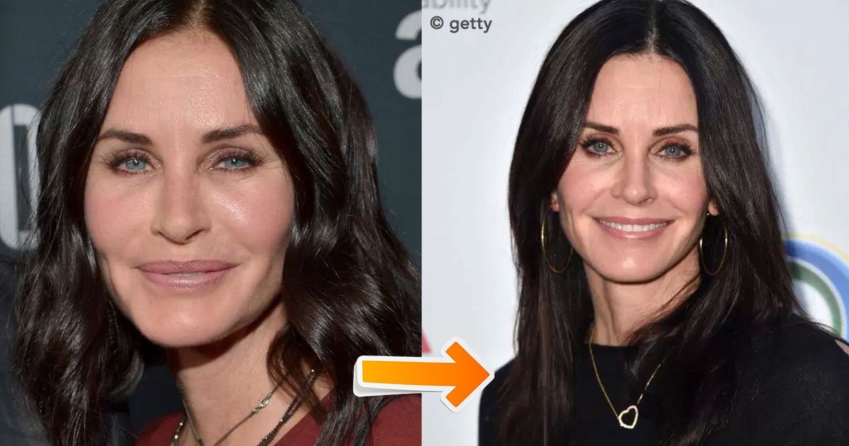 getty.jpg?resize=412,275 - Courteney Cox hizo que todos sus rellenos faciales se disolvieran y se ve genial