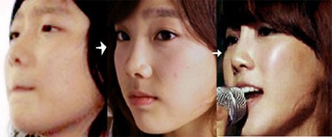 目と鼻とお腹と ボロボロでてくる少女時代テヨンの整形疑惑は本当 Hachibachi 目と鼻とお腹と ボロボロでてくる少女時代テヨンの整形疑惑は本当 Hachibachi