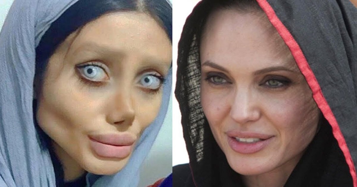 maxresdefault 18.jpg?resize=1200,630 - Une adolescente a déclaré avoir subi 50 chirurgies plastique pour ressembler à Angelina Jolie, mais ce n'était pas vrai finalement