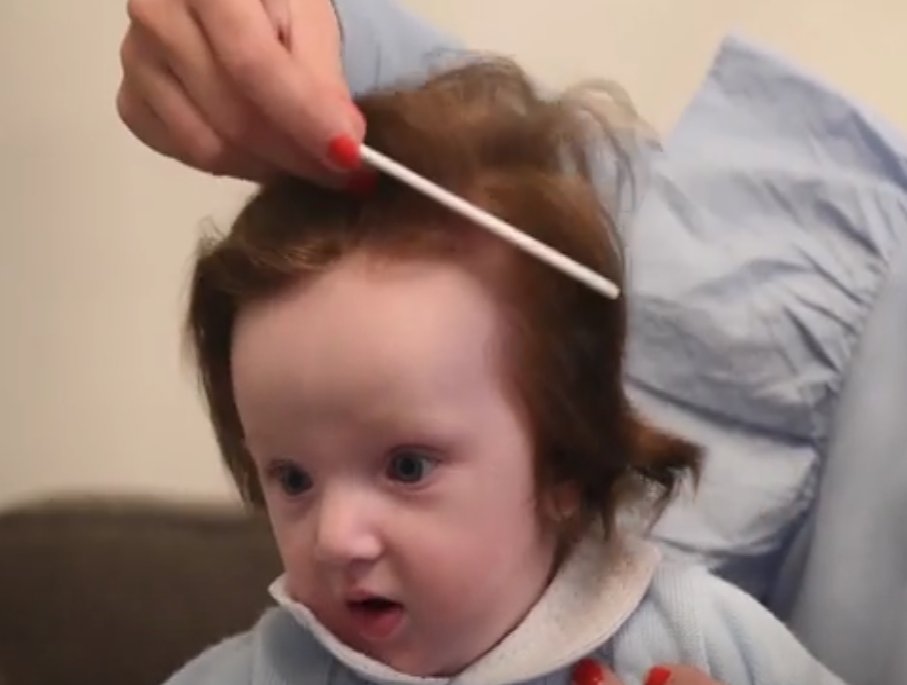 Ce Bebe Ne Avec D Etonnants Cheveux Bruns Fonces A Completement Change 5 Mois Apres Vonjour Ce Bebe Ne Avec D Etonnants Cheveux Bruns Fonces A Completement Change 5 Mois Apres Vonjour