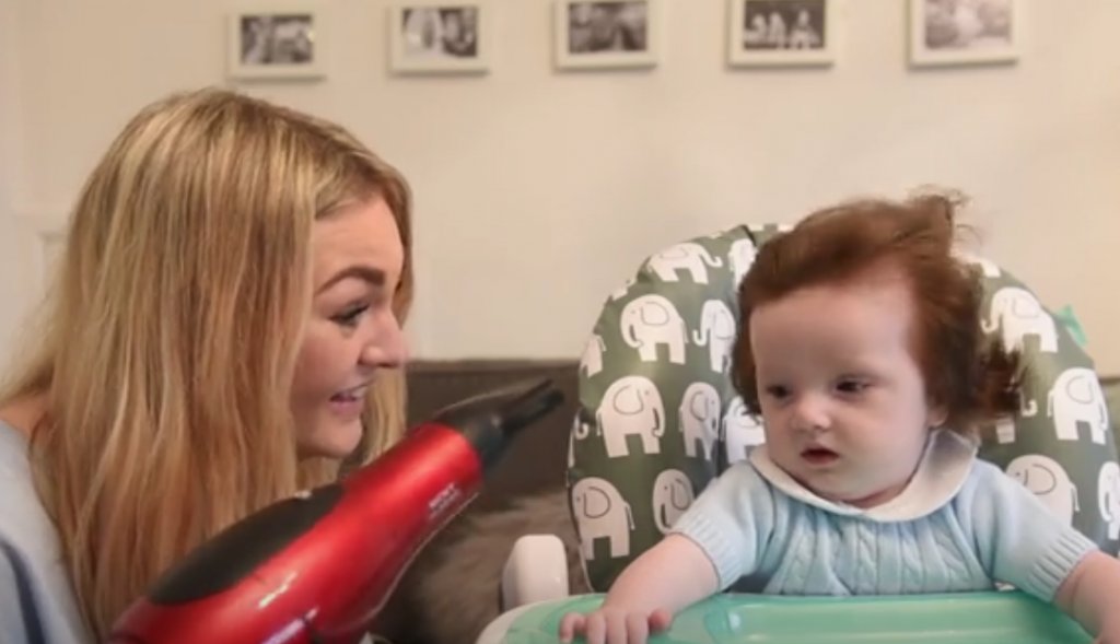 Ce Bebe Ne Avec D Etonnants Cheveux Bruns Fonces A Completement Change 5 Mois Apres Vonjour Ce Bebe Ne Avec D Etonnants Cheveux Bruns Fonces A Completement Change 5 Mois Apres Vonjour