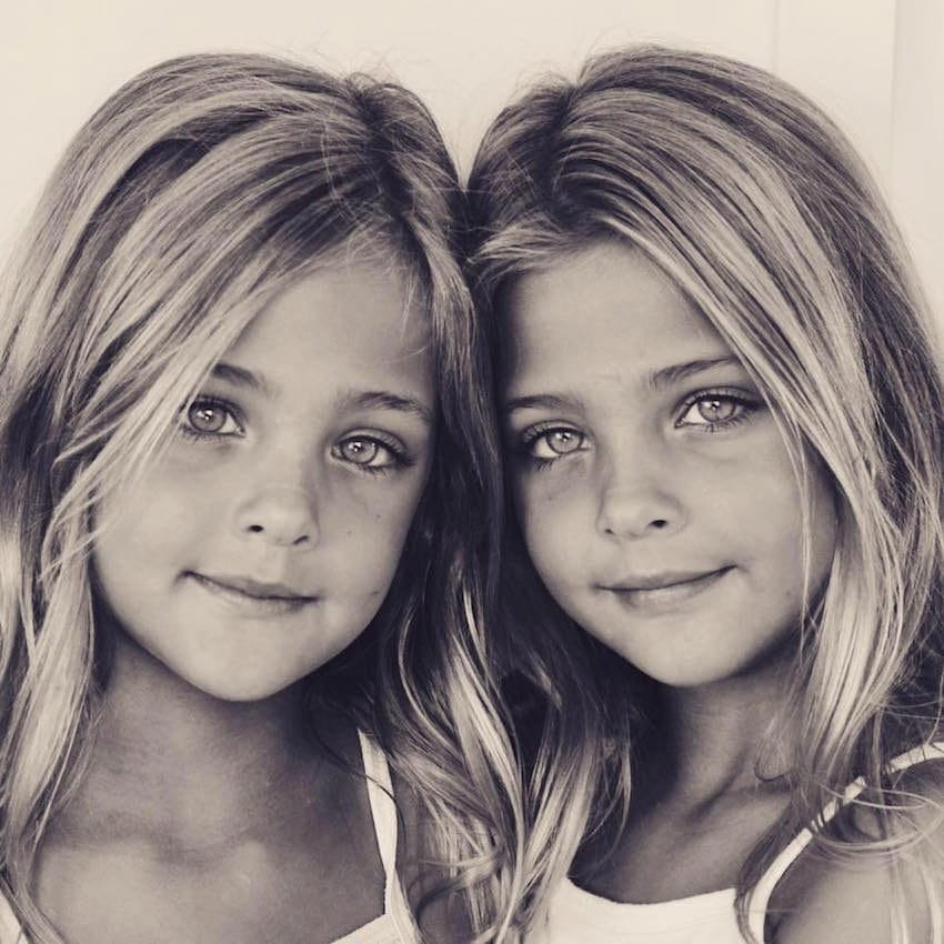 7 84 1.jpg?resize=412,275 - 7-Year-Old Sisters Became The Most Beautiful Twins In The World