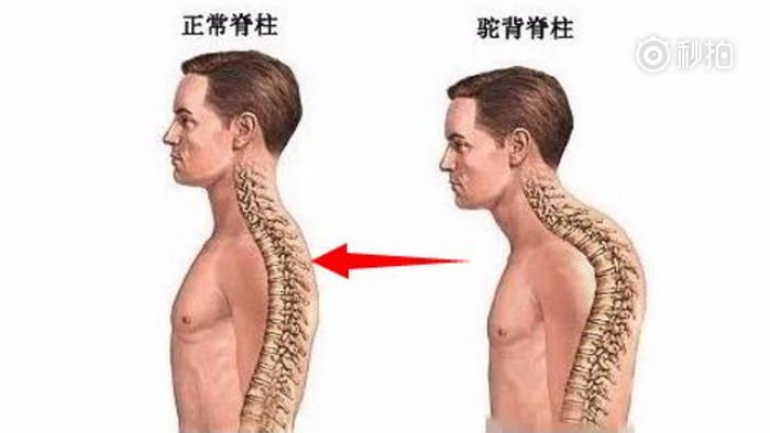 따라하기만 하면 키 3cm 큰다는 '거북목' 셀프 교정법5 221711582uc5829ldm73 - 따라하기만 하면 키 3cm 큰다는 '거북목' 셀프 교정법5